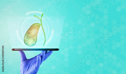 Gallbladder with stone. Care and treatment of gallstones, cholecystitis, surgical removal. The doctor's hand holds a tablet. It shows a gallbladder on a light blue background.