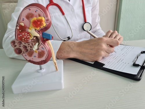 Doctor artificial kidney model with inflammation concept photo