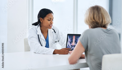 Картината върху платно Doctor, woman and tablet with spine x ray, feedback or advice for injury, pain or talking with app for support