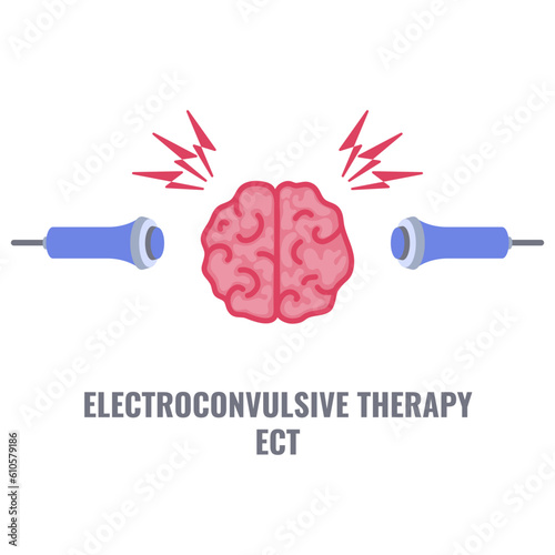 Electroconvulsive therapy for severe depression and schizophrenia treatment. ECT electrodes placement. Brain stimulation equipment for bipolar and major depressive disorders. Vector illustration. photo