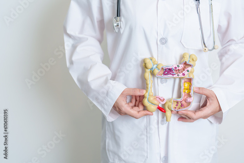 Doctor holding human Colon anatomy model. Colonic disease, Large Intestine, Colorectal cancer, Ulcerative colitis, Diverticulitis, Irritable bowel syndrome, Digestive system and Health concept photo