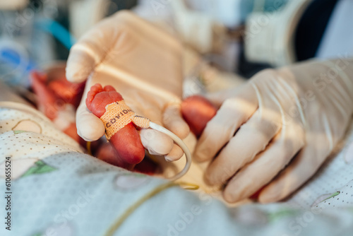 Bild auf Leinwand Three-day-old newborn baby in intensive care unit in a medical incubator