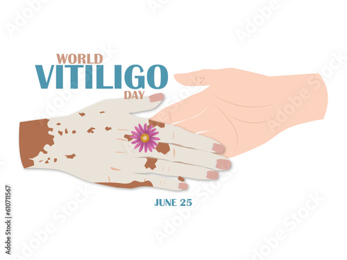 World Vitiligo Day.June 25.Two hands joining hands on a white background, one of them with vitiligo and one without to avoid the stigmatization of this disease. photo
