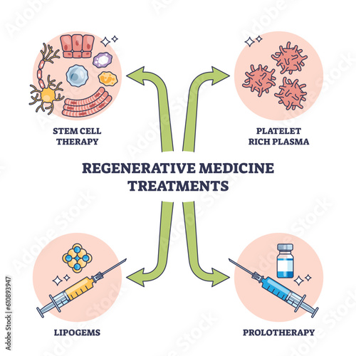 Regenerative medicine treatment methods for patient cure outline diagram. Labeled list with stem cell, platelet rich plasma, lipogems and prolotherapy injection for health therapy vector illustration