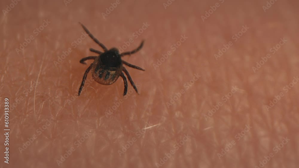 Macro of a tick searching for suitable bloodsucking site on human skin Macro of a tick searching for suitable bloodsucking site on human skin