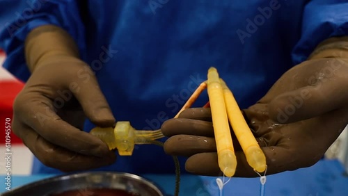 4K footage of doctor in surgical gown and gloves holding penile implant in operating room. Surgeon squeezing pump of inflatable penile implant cylinders stock video.  photo