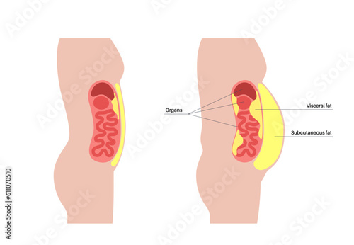 Visceral fat diagram