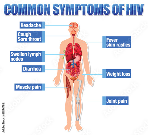 Informative poster of common symptoms of HIV