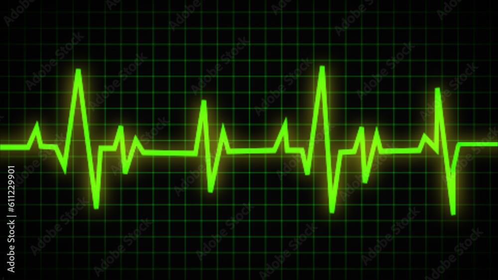 Electrocardiogram, or ECG. End of the life-beat line. health medical heartbeat pulse art design. visual element with an abstract notion Electrocardiogram, or ECG. End of the life-beat line. health medical heartbeat pulse art design. visual element with an abstract notion