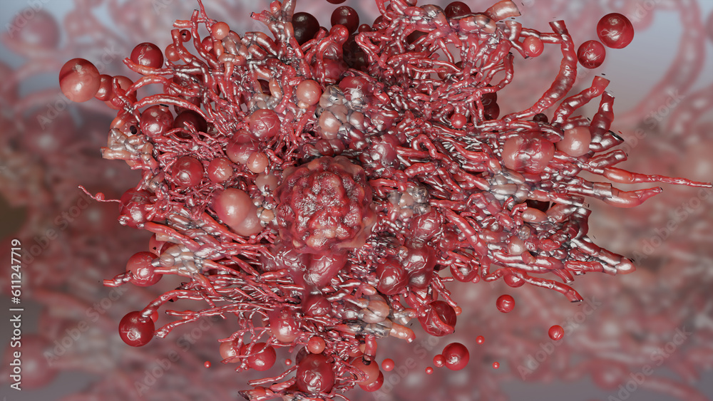 Cancer cell growth uncontrollably over tissue, Tumor infection cells ...