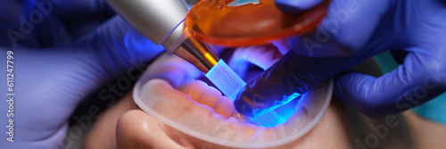 Dentist treating caries and illuminating seal with ultraviolet lamp closeup. Modern dentistry concept