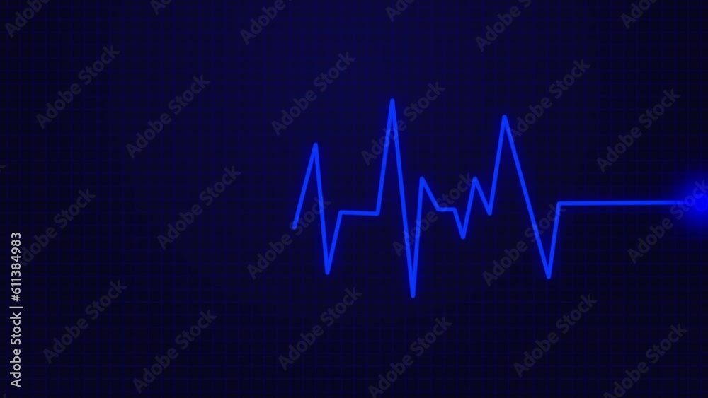 Green screen with neon cardiac rate and pulse. a cardiogram. Monitor for heartbeat EKG Cardiogram. Monitor of Heart Rate Electrocardiogram EKG Green screen with neon cardiac rate and pulse. a cardiogram. Monitor for heartbeat EKG Cardiogram. Monitor of Heart Rate Electrocardiogram EKG