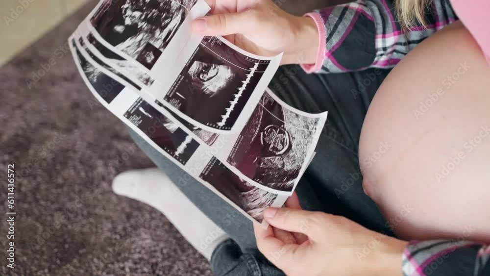 Happy mother kissing ultrasound scan pictures of her baby child, future