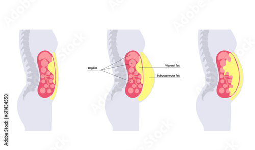 Visceral fat diagram