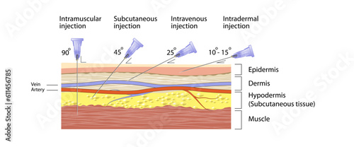 Types of injection vector illustration. intramuscular, subcutaneous, intravenous, intradermal. skin layers types epidermis, dermis, hypodermis and muscle. Basic Medical science study material. layers photo