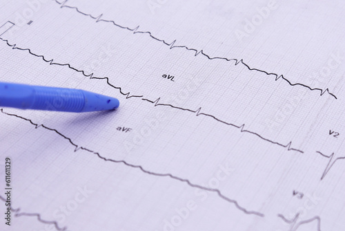 heart rhythm ekg note on paper doctors use to analyze heart disease treatment illustration on a white background