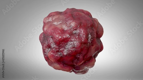Cancer cell growth uncontrollably over tissue, Tumor infection cells and spreading, Invasive inflammation and metastasis cancerous. reproduce by duplicating, cells expanding, Disease, 3d render
