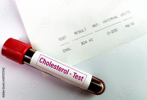Blood sample with abnormal high report of Cholesterol test. photo