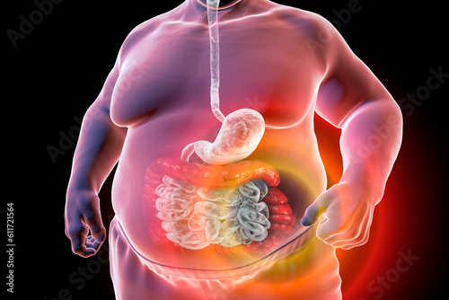 A 3D medical illustration depicting the upper half part of a senior obese male body with a highlighted digestive system, showcasing large bowel spasms photo