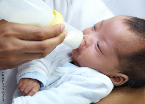 Canvas Print Baby with cleft lip, milk and mom feeding from bottle for nutrition, health and wellness