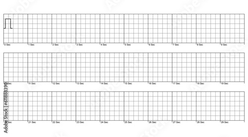 Electrocardiogram, ecg grid graph, Ruler grid vector illustration isolated on white background. Set of rulers