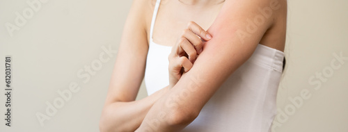 Dermatology, asian young woman reaction from atopic, insect bites on her arm, hand in scratching itchy red spot or rash of skin. Healthcare, treatment of beauty.
