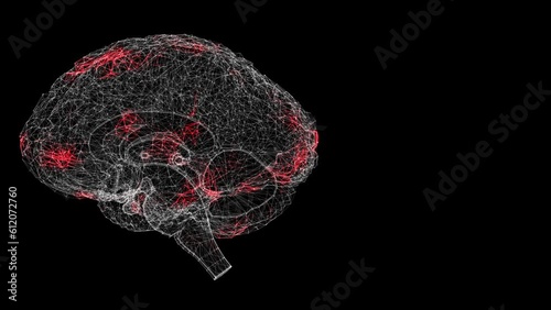 Spread of virus through 3D human brain on black background. Visual demonstration of virus in the body. Tutorial Video. Science Medical concept. 60 FPS 3D animation