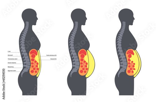 Visceral fat diagram