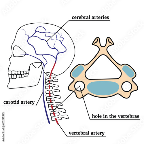 The contour of the skull with the spine. Infographic with vertebral artery syndrome. Medical poster. Vector illustration
