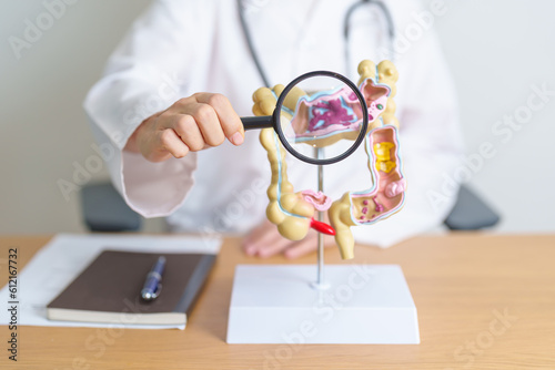 Doctor with human Colon anatomy model and magnifying glass. Colonic disease, Large Intestine, Colorectal cancer, Ulcerative colitis, Diverticulitis, Irritable bowel syndrome and Digestive system photo