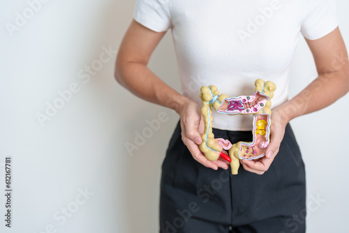 Woman holding human Colon anatomy model. Colonic disease, Large Intestine, Colorectal cancer, Ulcerative colitis, Diverticulitis, Irritable bowel syndrome, Digestive system and Health concept photo