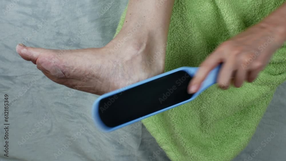 The female uses a sanding brush to exfoliate her foot. Treatment of