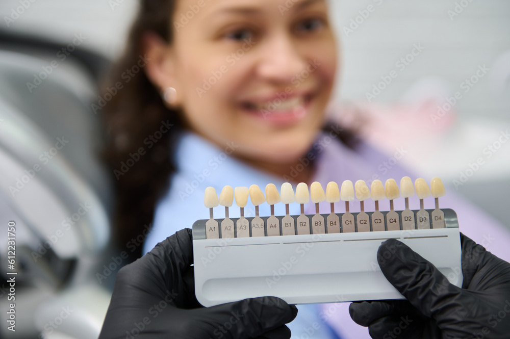Selective focus on tooth color chart in the gloved hands of a doctor