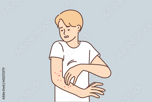 Man with rash on arm suffers from itching and eczema caused by infection that affects skin