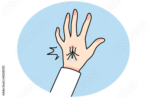 Close up of mosquito bite hand. Bug or insect biting person leave spot or mark. Healthcare and nature. Vector illustration.