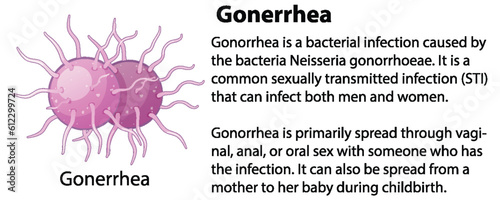 Gonorrhea virus with explanation