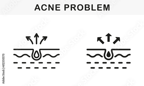 Skin Acne, Pimple, Comedo Pictogram. Blackhead and Inflammation Sebum Line and Silhouette Black Icon Set. Dirty Skin Problem Symbol Collection. Isolated Vector Illustration