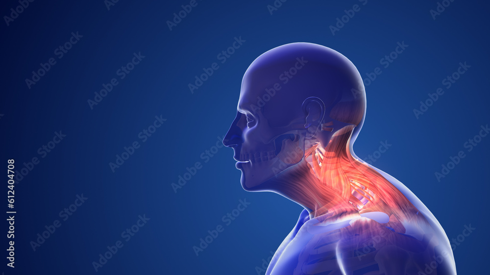 Cervical postural syndrome or neck pain 3d illustration Cervical postural syndrome or neck pain 3d illustration