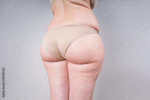 Overweight thigh, woman with fat hips and buttocks, obesity female body with cellulite on gray background