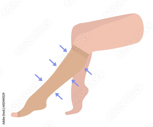 Women's Knee-high compression stockings with open toe. Medical underwear for female legs and feet. Specialized hosiery for varicose veins with pain and swelling. Vector illustration for medicine.