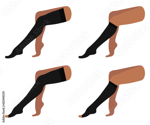 Set of compression stockings, knee-high, socks, open toe. Black color, dark skin. Female legs sitting with varicose veins. Blood pressure, swelling. Medical underwear for feet. Hosiery for diseases.