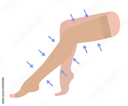 Women's compression stockings with open toe. Medical underwear for female legs and feet. Specialized hosiery for varicose veins with with pain and swelling. Vector illustration for medicine.