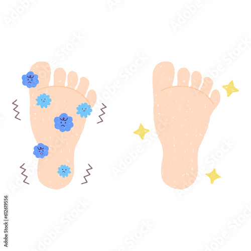 きれいな足の裏と菌が繁殖する足の裏