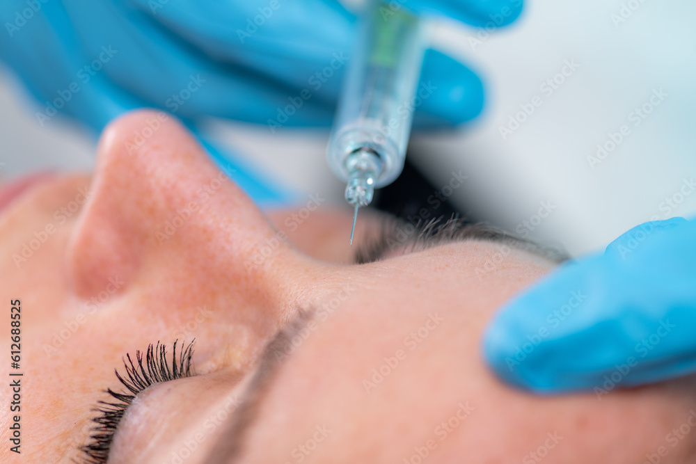 Foto de Treating forehead lines with hyaluronic acid filler, a