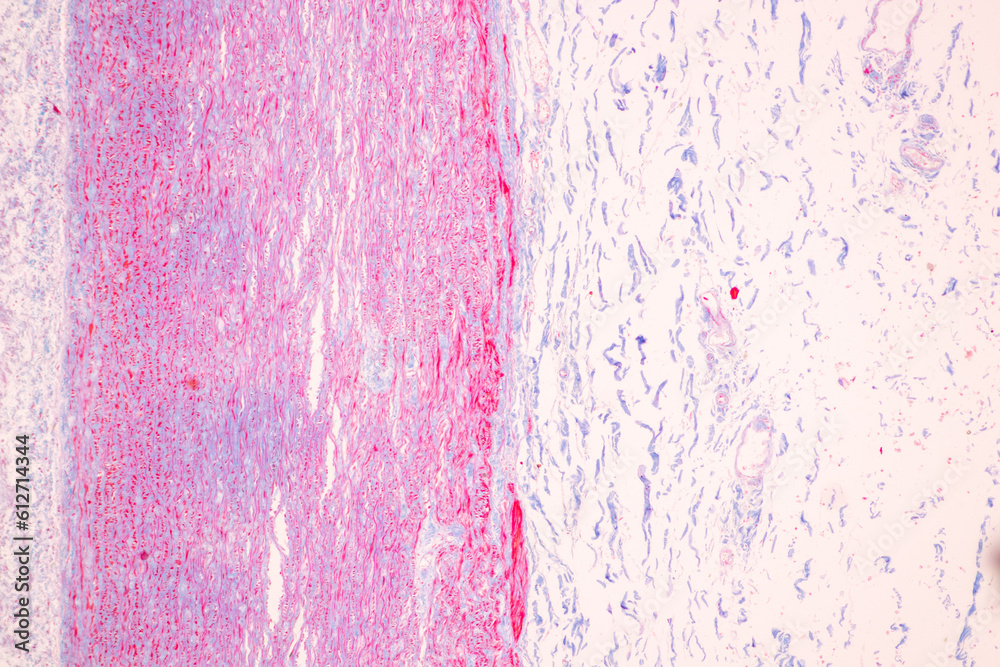 Tissue of Vein, Artery and Aorta Human under the microscope in Lab. Tissue of Vein, Artery and Aorta Human under the microscope in Lab.