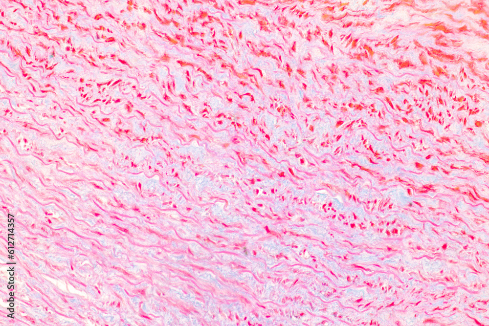 Tissue of Vein, Artery and Aorta Human under the microscope in Lab. Tissue of Vein, Artery and Aorta Human under the microscope in Lab.