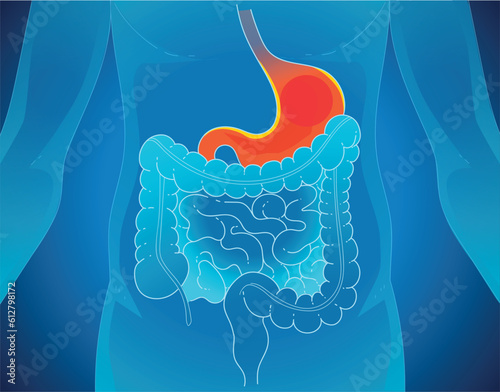 A human body with health problems. Inflammation on the stomach. Stomach (peptic) ulcer. Healthcare illustration. Medical illustration. Vector illustration. 