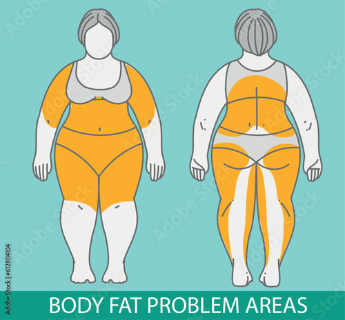 Body fat problem areas. Medical infographic. Healthcare illustration. Vector illustration. 
