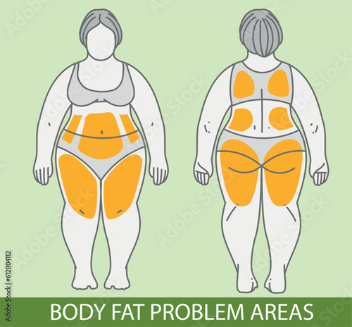 Body fat problem areas. Medical infographic. Healthcare illustration. Vector illustration. 