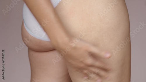Close-up view of unrecognizable middle age woman wearing white underwear, squeezing skin of hip, buttock with hands, showing cellulite. Skin care, body care, lymphatic drainage, obesity 4K photo